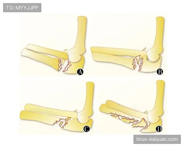 判罚争议中的裁判判定标准及常见误区解析